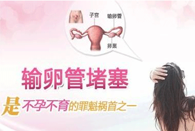 输卵管粘连怎么检查