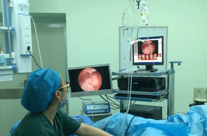 宫腔镜手术伤害大吗