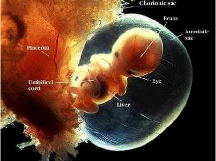 羊水浑浊的原因