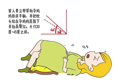 早期破水有哪些症状