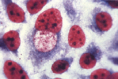 衣原体阳性怎么治疗