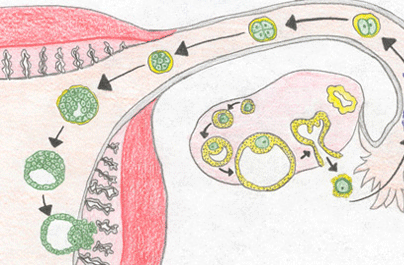 输卵管不孕怎样治疗