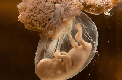 羊水指数正常范围