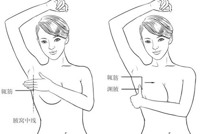 如何预防轻度乳腺增生